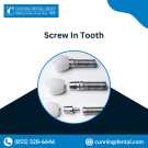Screw In Teeth | Denture Implants | Overdenture CA