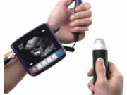 MiniScan Veterinary Mini Ultrasound Scanner